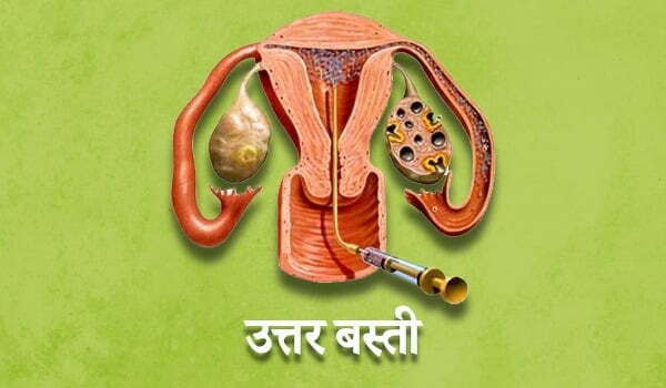 Uttar Basti (उत्तर बस्ती)